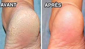 Soins bien être du pied pour femme