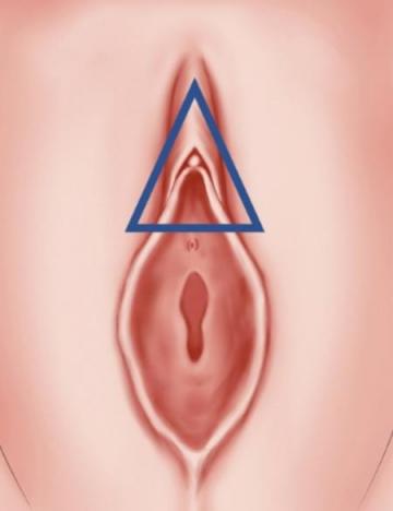Dilatation des Zones �rog�nes